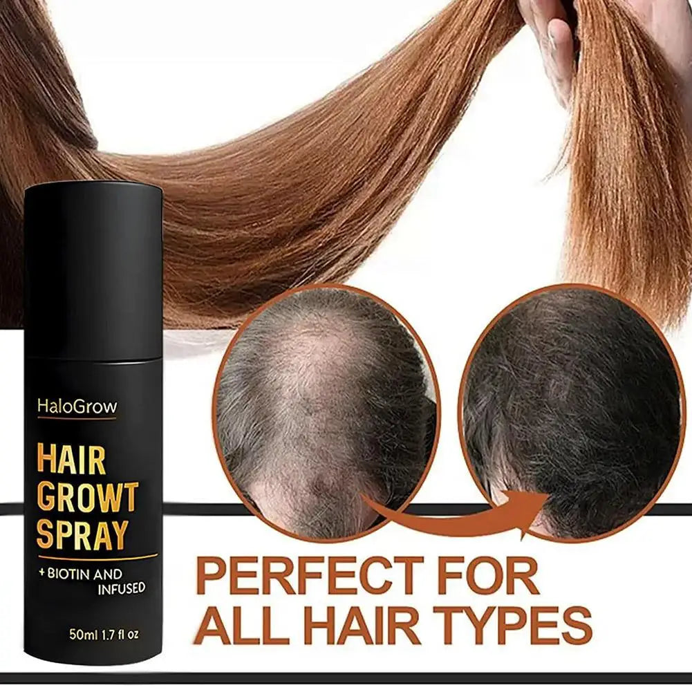 50 ml Haarwachstumsspray fördert die Gesundheit von Haarfollikeln, Melanin-Produktion, Haarverdickungsbehandlung für die Haarpflege von Männern und Frauen