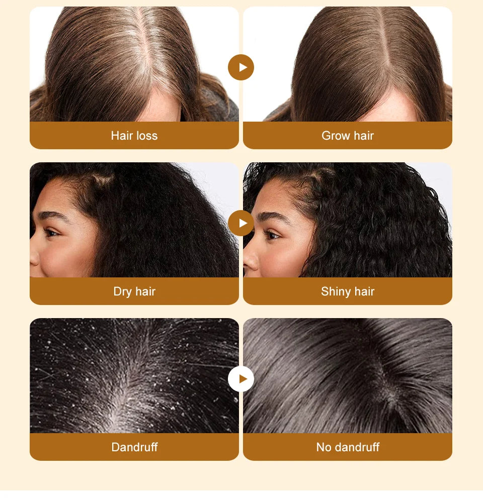 Lewedo Naturals Batana-Öl, schnelles Haarwachstum für Männer und Frauen, reines Batana-Öl, nährt glänzendes Haar, gesunde Haarpflege, Anti-Haarausfall