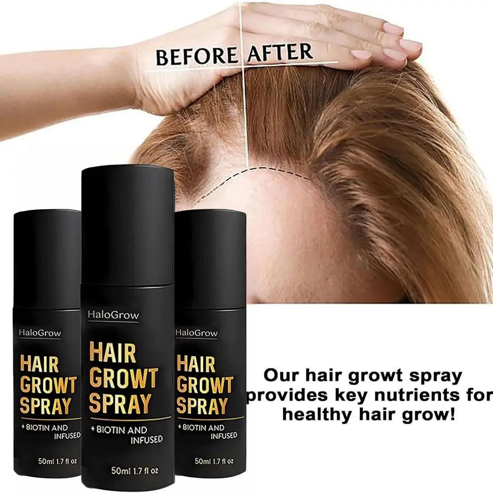 50 ml Haarwachstumsspray fördert die Gesundheit von Haarfollikeln, Melanin-Produktion, Haarverdickungsbehandlung für die Haarpflege von Männern und Frauen