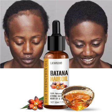 Lewedo Naturals Batana-Öl, schnelles Haarwachstum für Männer und Frauen, reines Batana-Öl, nährt glänzendes Haar, gesunde Haarpflege, Anti-Haarausfall
