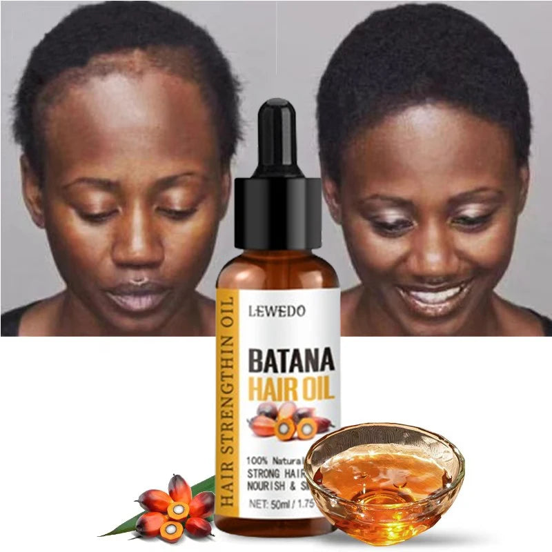 Lewedo Naturals Batana-Öl, schnelles Haarwachstum für Männer und Frauen, reines Batana-Öl, nährt glänzendes Haar, gesunde Haarpflege, Anti-Haarausfall