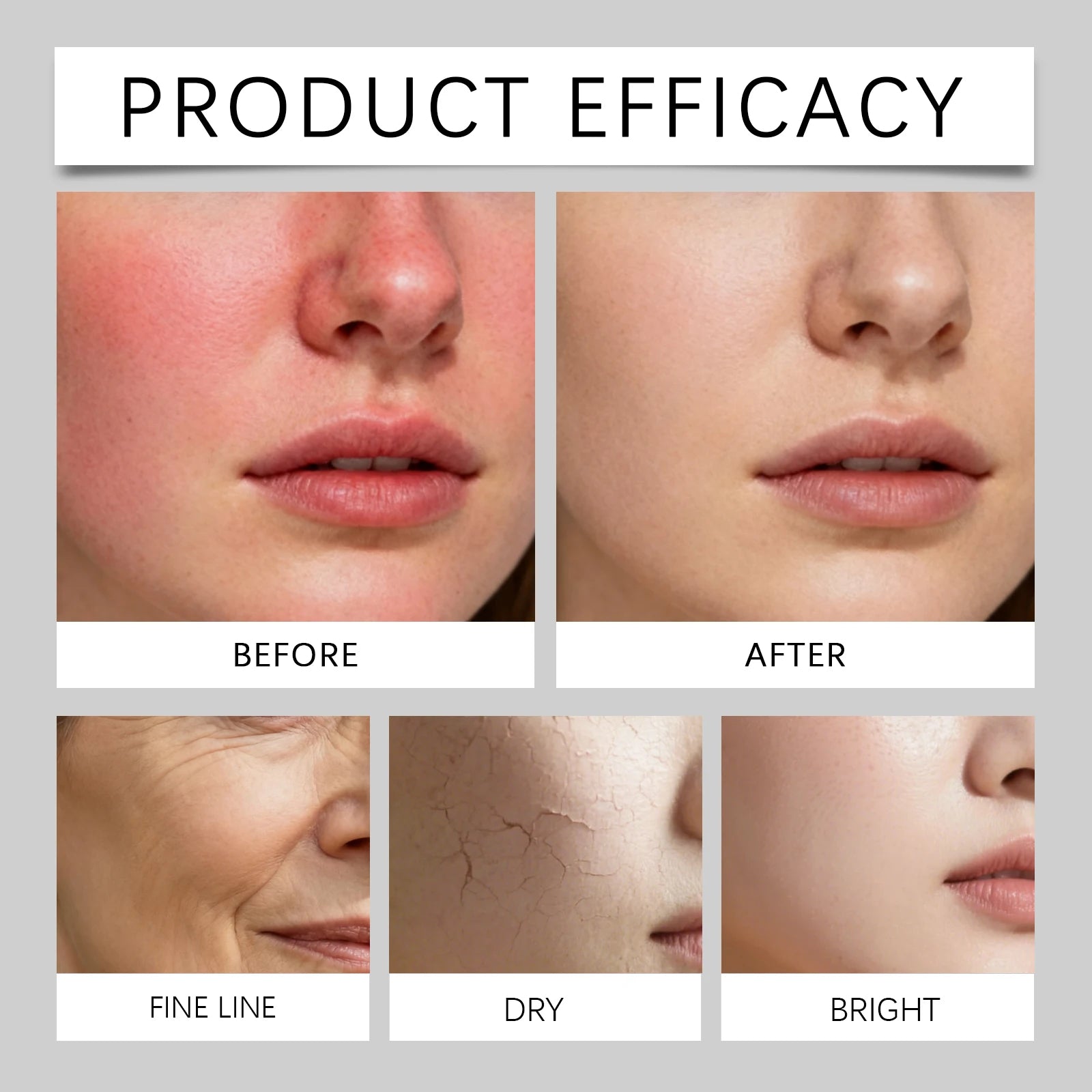 Multi-Action beruhigende Reparaturcreme für das Gesicht, Teebaumcreme, Centella Ceramide Aloe Vera Feuchtigkeitscreme für empfindliche und fettige Haut