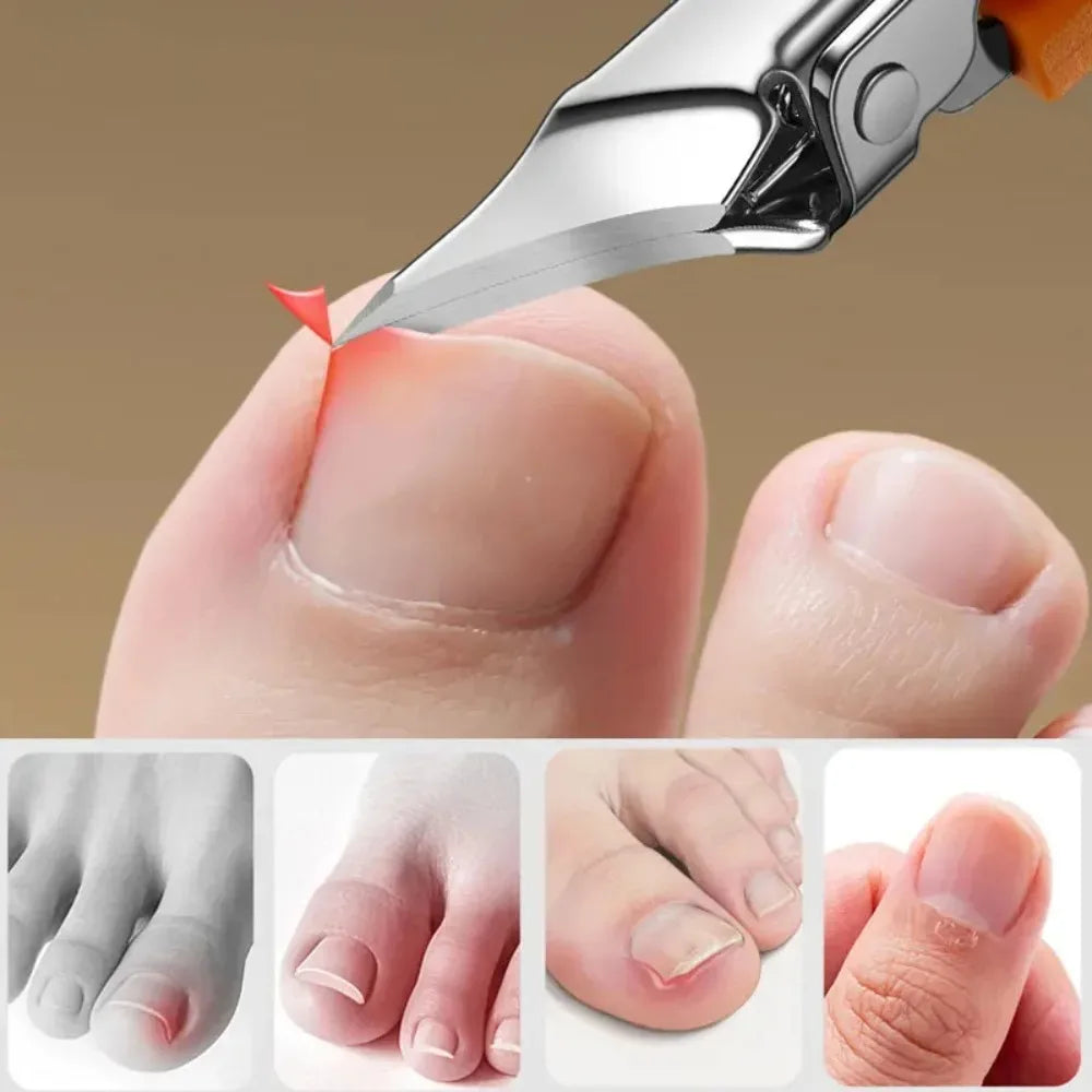 25 °   Nagelknipser mit schräger Kante, breite Öffnung, Edelstahl, professionelle Werkzeuge für eingewachsene Zehennägel, Adlerschnabel, schräge Zehennagelschneider